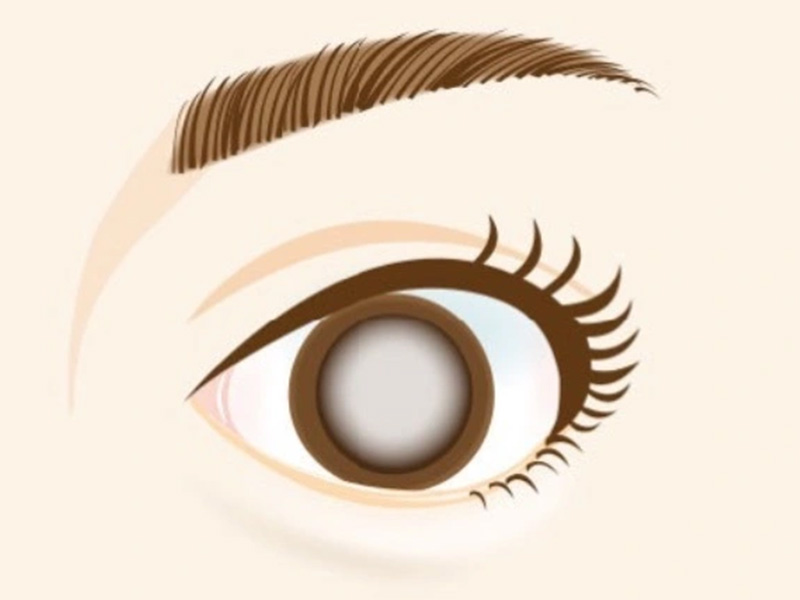 日帰り白内障手術