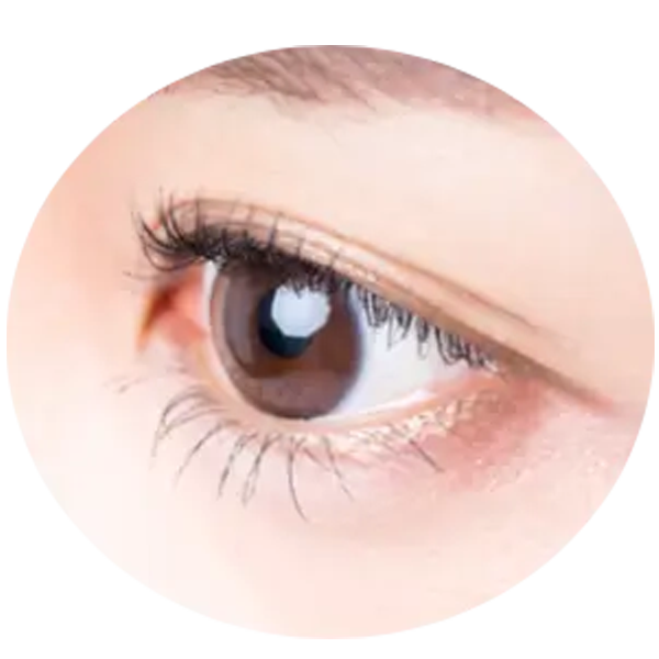 その他網膜疾患